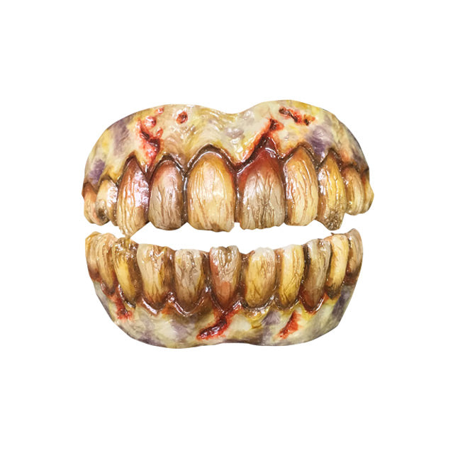 Costume teeth.  Rotten teeth set in bony discolored gums.