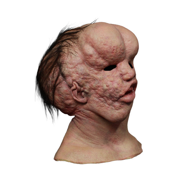 Mask, head, neck and collarbones. right side view. The Elephant Man face, enlarged bulbous forehead, right side of face enlarged and bumpy, misshapen nose and mouth, short sparse dark hair on sides and back of head.