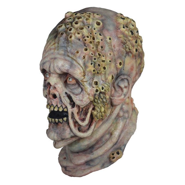 Mask, head and neck, left view. Pale blueish, waterlogged flesh, dripping from cheeks and back of head. Barnacles, mainly on the left side of face and top of head, also on chin and neck. Mouth open showing dirty teeth.