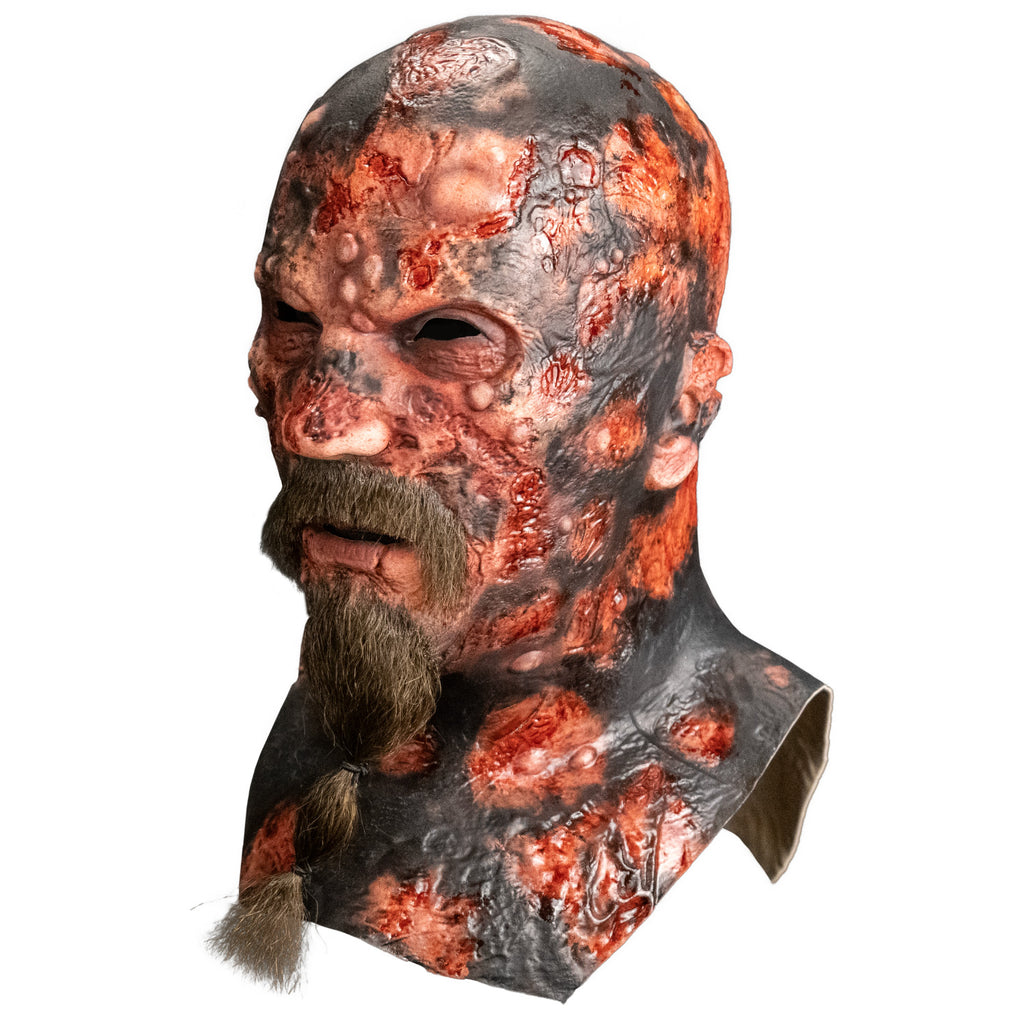 Mask, left view, head, neck and upper chest. Charred and blistered flesh. Bald, no eyebrows, mouth slightly open, light brown moustache and beard, tied with two hair ties.