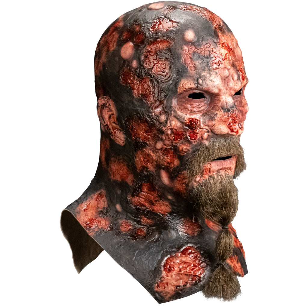 Mask, right view, head, neck and upper chest. Charred and blistered flesh. Bald, no eyebrows, mouth slightly open, light brown moustache and beard, tied with two hair ties.