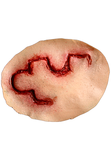 outline of puzzle piece shaped wound, appliance